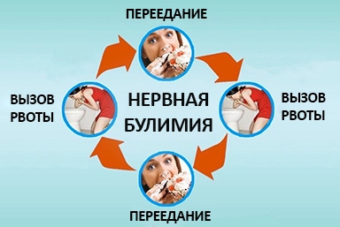 Лечение булимии в Родники